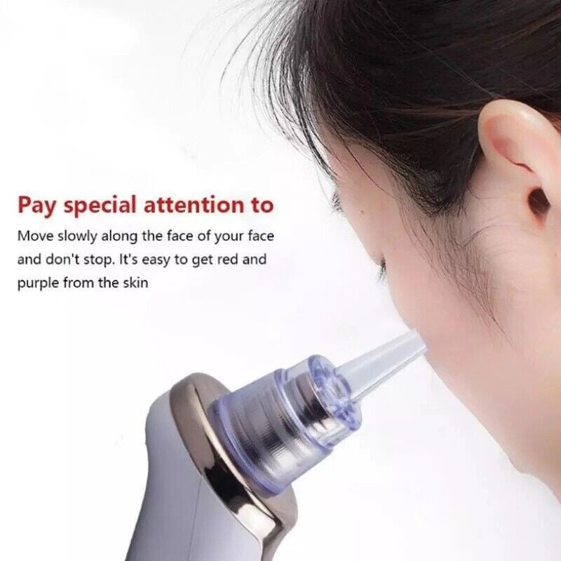 Electric Blackhead Remover Pore Vacuum Suction Diamond Dermabrasion Face Cleaner
